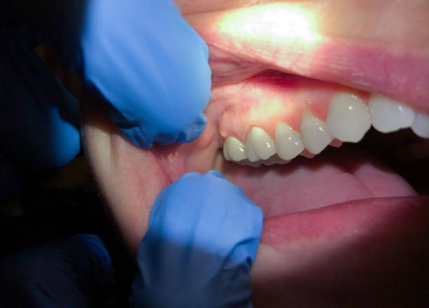 Best Emergency Tooth Extraction  in Christiansburg, VA