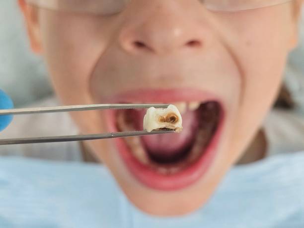Best Teeth Whitening  in Christiansburg, VA